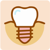 icono-implantes-2
